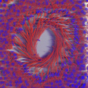 B0006849 Seminiferous tubule