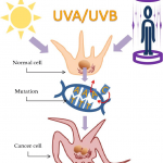 The effect of UV radiation on skin cells